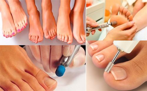 Processo e risultato di pedicure hardware