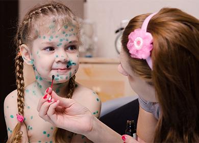 La ragazza a punti dal verde