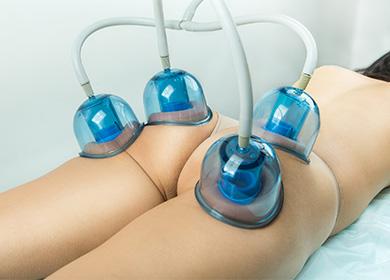 Massaggio con banche di cellulite