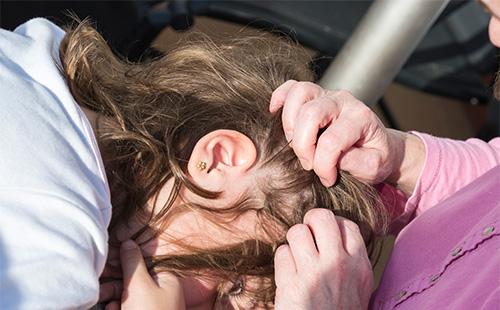 Prende i pidocchi dai capelli